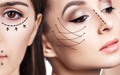 Changes to Botox regulation welcome news!